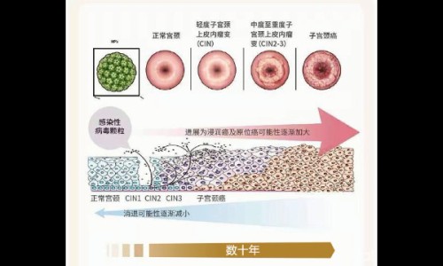 甲状腺结节可以用药外敷吗有效果吗-甲状腺结节可以用药外敷吗图片-甲状腺结节可外敷消肿吗,中国甲状腺结节可以用药外敷吗网站